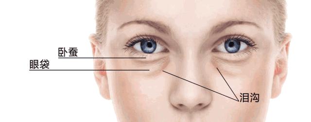 祛除眼袋的小妙招红霉素软膏,男生怎么祛除眼袋最快最有效