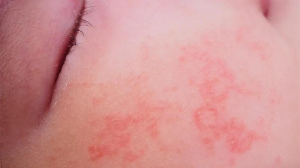 儿童化妆品检出致敏源,婴幼儿面霜是否有毒