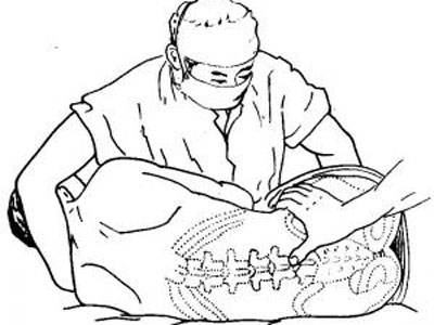 腰椎间盘突出选择合适自己治疗方式才是最重要的