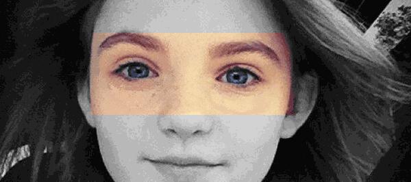 眼袋消除三个方法,教你一个简单消除眼袋的方法