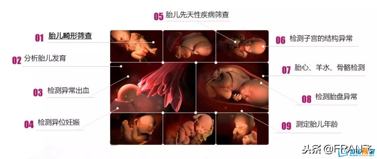 “四维彩超”主要查这些，准妈妈你都知道吗？