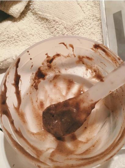 汗管角化症最佳治疗方法,汗管毛囊角化瘤