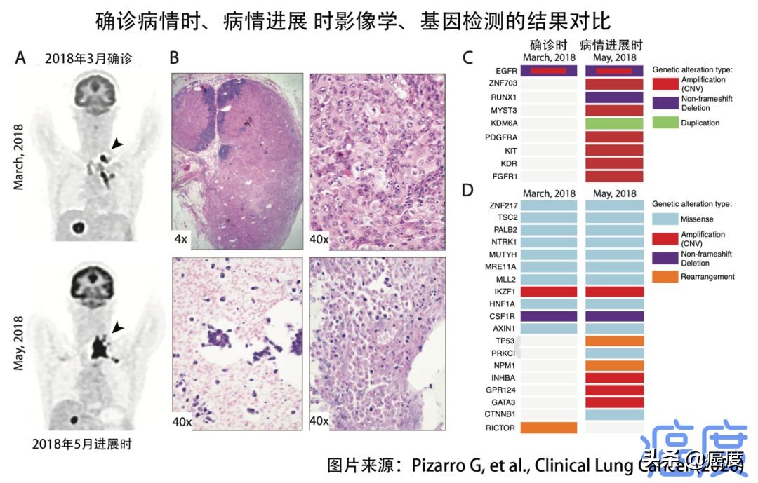 egfr突变肺癌无化疗时代,肺癌egfr阴性pd1靶向治疗