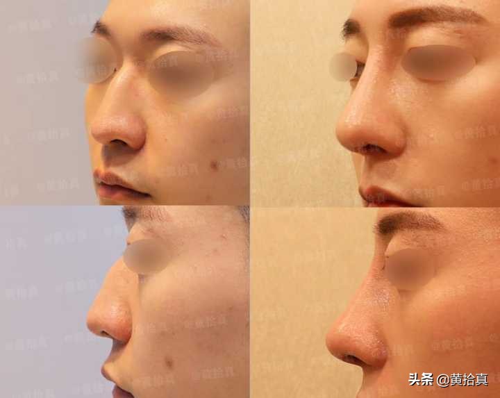 一个长得丑的男生,怎样才能全方位地变帅,改造自己?