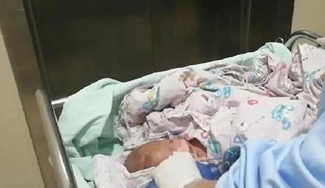 婴儿被插了针有什么表现,婴儿身体被扎缝衣针