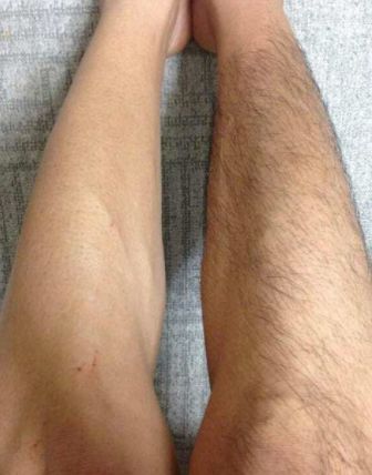 不能说的秘密男女体毛打理指南