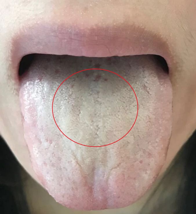 女人宫寒保健护理措施,调理痛经宫寒食疗