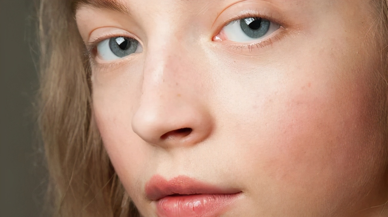 皮肤敏感泛红起疹修复,泛红刺痛干痒如何修复