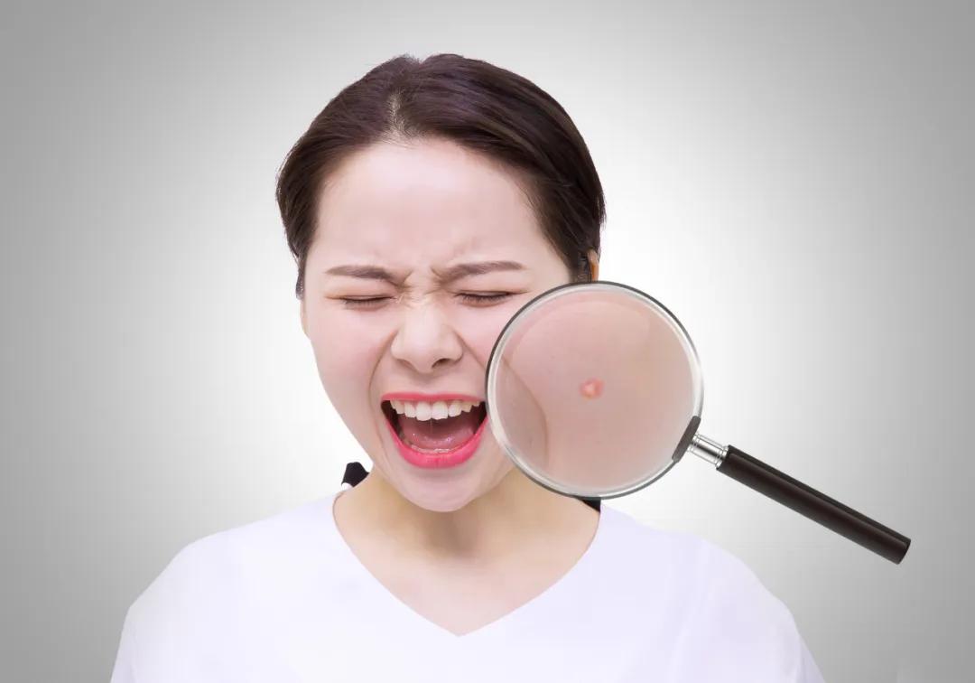 痘痘总是治不好怎么回事,痘痘怎么一直消不掉