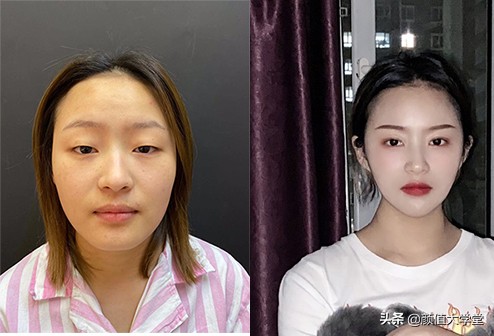 歌手黄霄云整容过吗,黄霄云参加歌手淘汰了谁