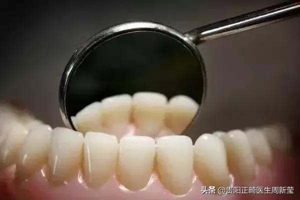 牙齿开瓶盖是嫌它太硬吗?牙齿使用说明书,简直太绝了