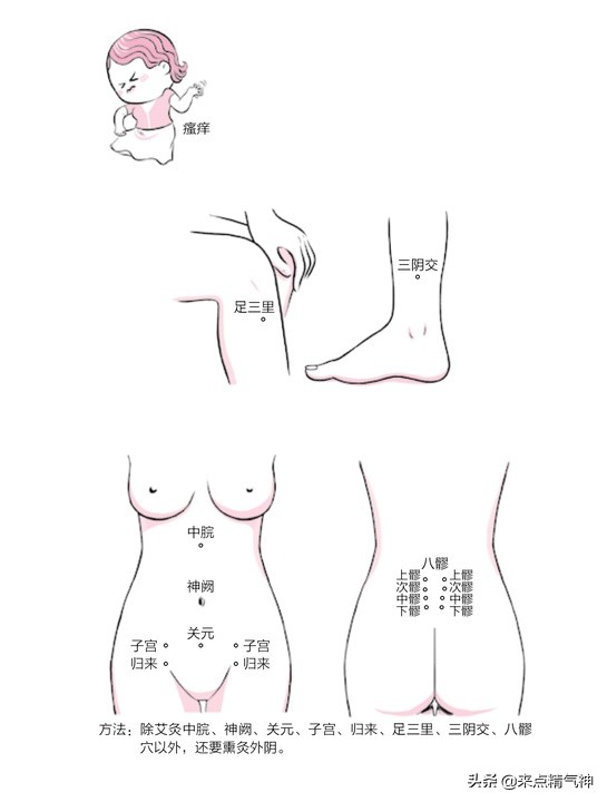 外阴瘙痒艾灸应灸什么地方,妇科瘙痒症诱发原因