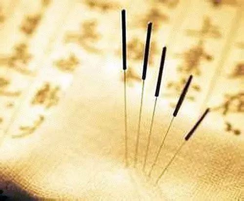 抗抑郁的心理治疗,中医情绪疗法治疗焦虑