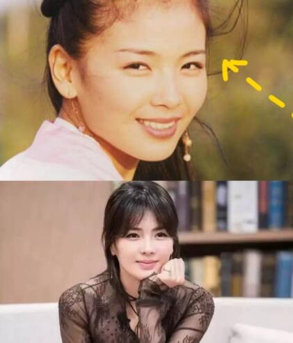 人中长颧骨高适合什么发型,人中长太阳穴凹陷