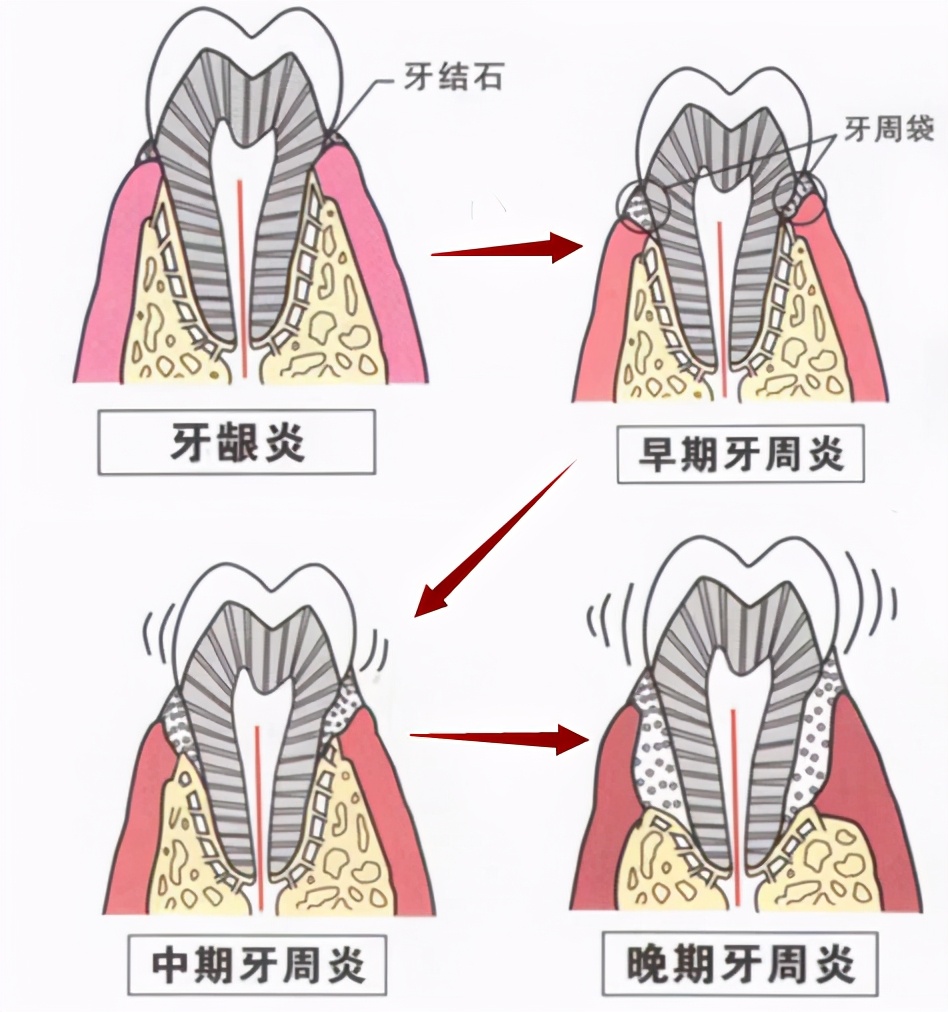 倪海厦讲白糖,猪油加白糖倪海厦