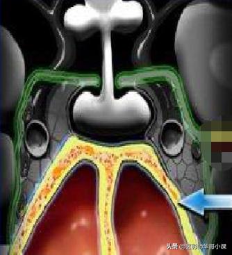 12岁垂体偏小是生长激素缺乏吗,儿童脑垂体偏小与生长激素的关系