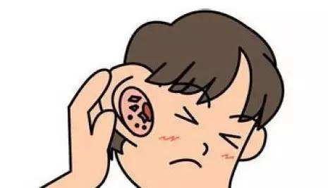 神经性耳鸣做高压氧舱治愈了,外伤引起神经性耳鸣能治愈吗