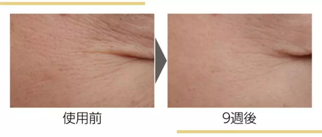 资生堂口碑最好的4款,在日本销量高产品