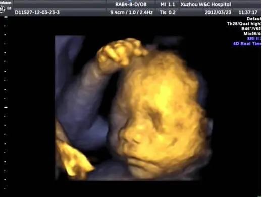 四维老是检查不到心脏,四维彩超通不过是怎么回事