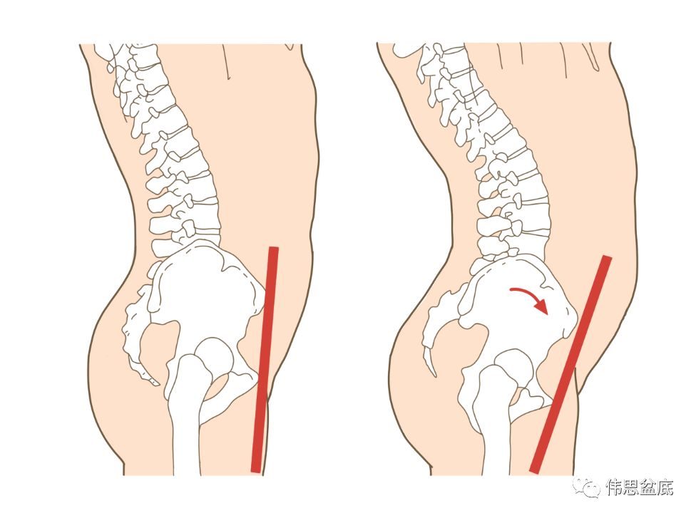 产后为什么消瘦不下来,产后为什么瘦不下来了