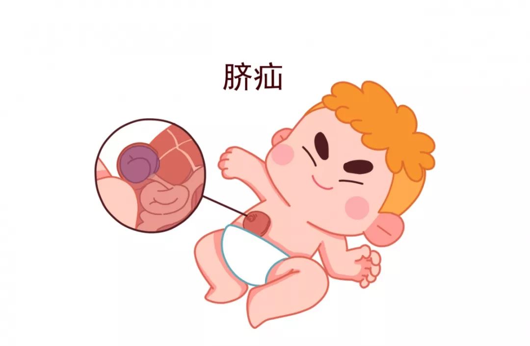 医生科普新生儿,医生必知的100个秘密