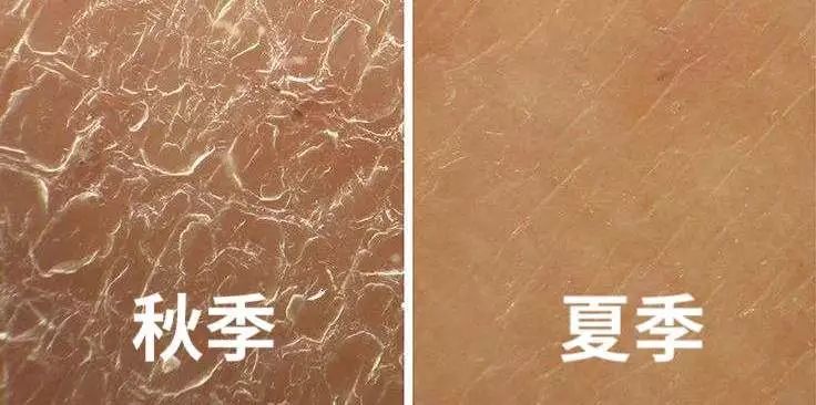 为什么秋天皮肤暗黄了,秋天肤色暗沉发黄