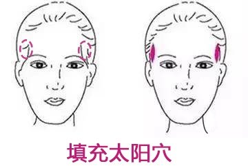 颧骨和下颌角有没有必要一起做,颧骨高割下颌角会老得快吗