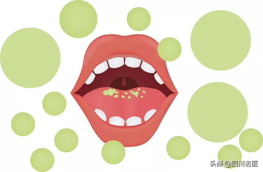 晚上刷牙后口苦是怎么回事,早起刷牙后口苦的症状消失