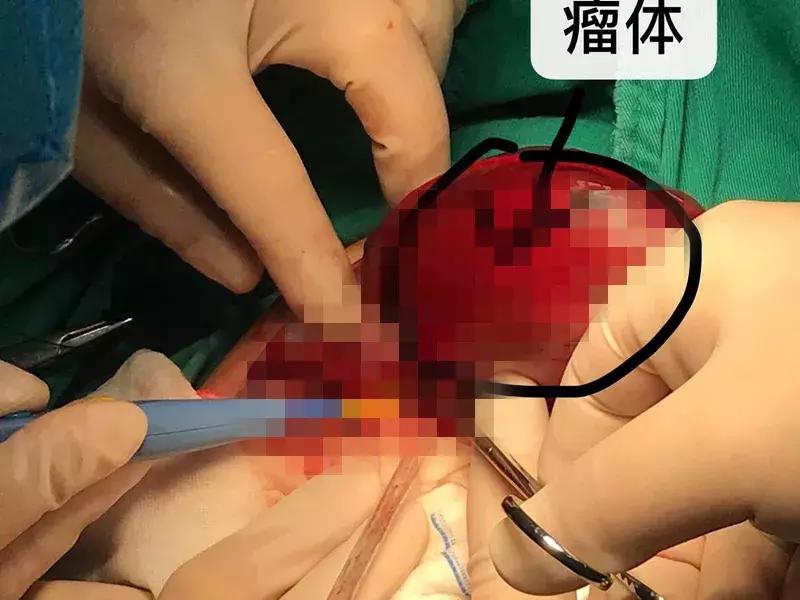 孩子刚生下来就抛弃了犯什么罪,孩子一出生就被抛弃