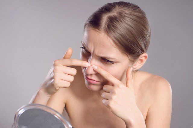 鼻子长痘最快的消除方法,12-15岁学生祛鼻子上的痘不花钱