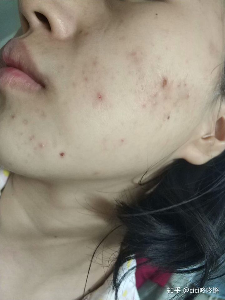 干货护肤教程手把手教你护肤,护肤亲身经验