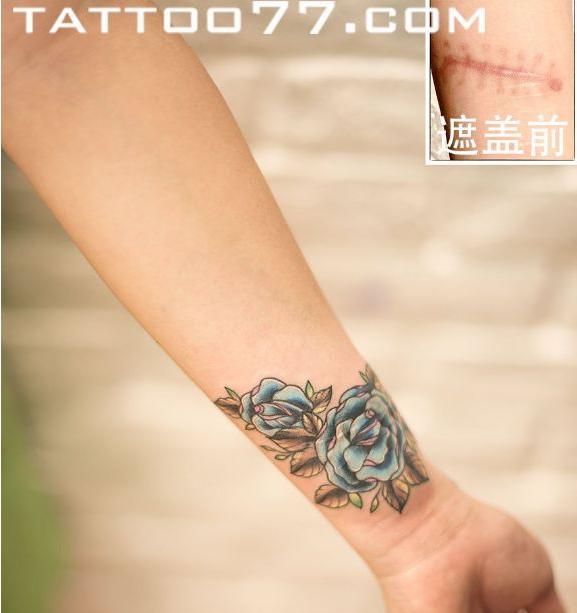 用纹身掩盖自己的伤疤,纹身是为了掩盖伤疤
