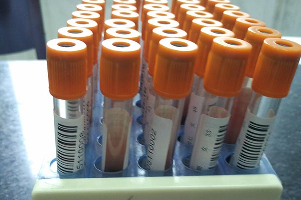 乙肝吃恩替卡韦需要注意什么,乙肝吃恩替卡韦应该注意事项