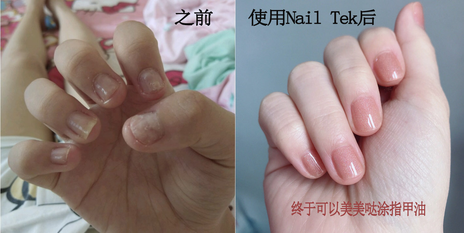 易劈易断还分层？美国专业沙龙修复甲油，给“病甲”快速“整容”