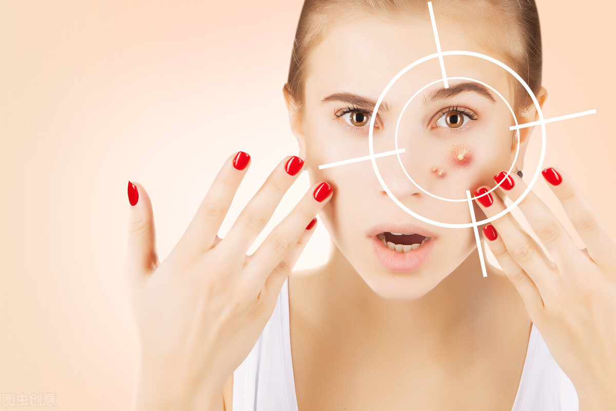 碘伏是不是可以祛痘,碘伏真的能祛痘吗