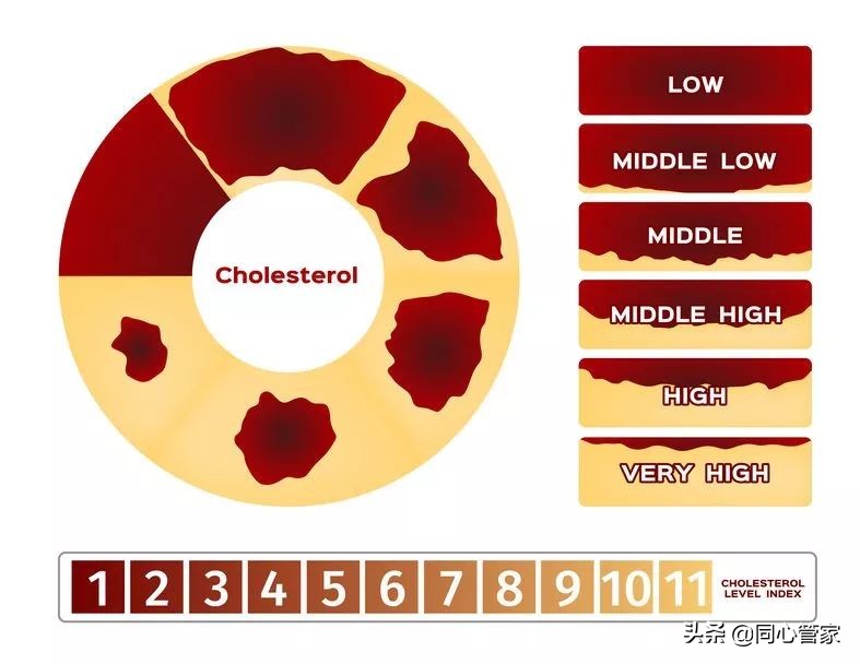 血管狭窄如何扼住生命的咽喉？让你全身器官都遭殃