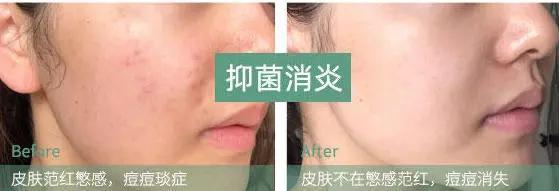 张韶涵海蓝之谜完整版视频,张韶涵小红书海蓝之谜