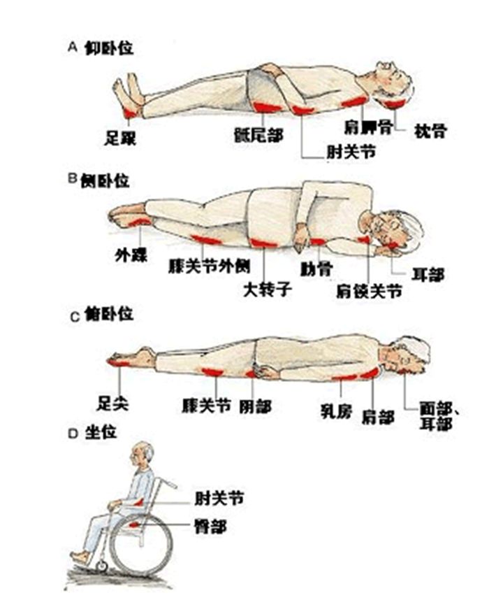 翻身起背防褥疮气垫,翻身气垫和防褥疮垫