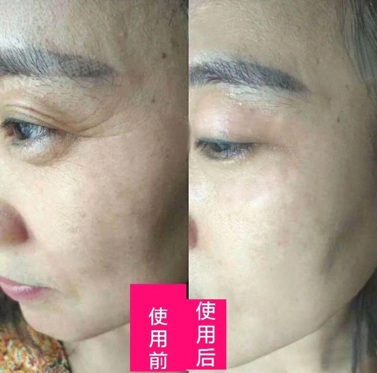 护肤界的“平价华为”崛起，打败宙斯雅萌，黄圣依宁静都在用