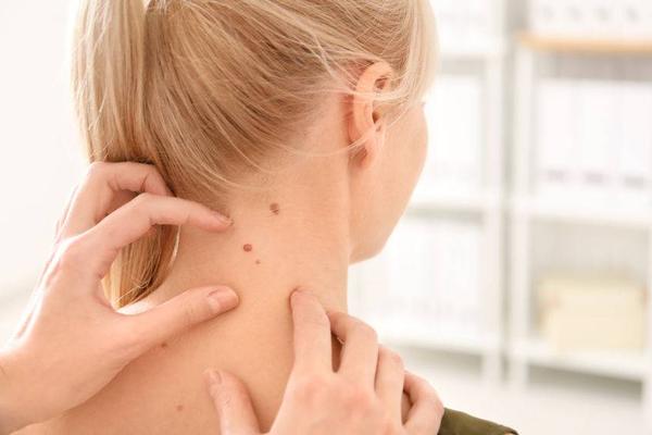 身上的黑痣癌变了叫什么癌症,屁股上突然长了颗黑痣是不是癌症