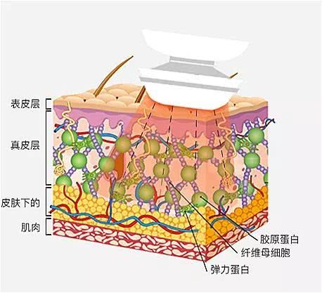 初普射频美容仪测评,家用射频美容仪哪个品牌最好