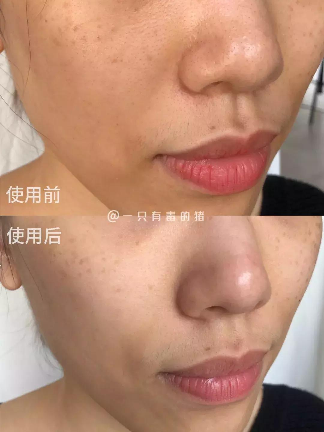 深层清洁面膜推荐网红,网红清洁面膜红黑榜