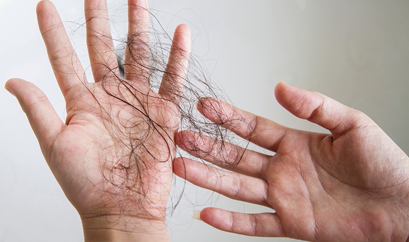 脂溢性脱发按摩头皮有用吗,脱发秃顶按摩哪个特效穴生发快