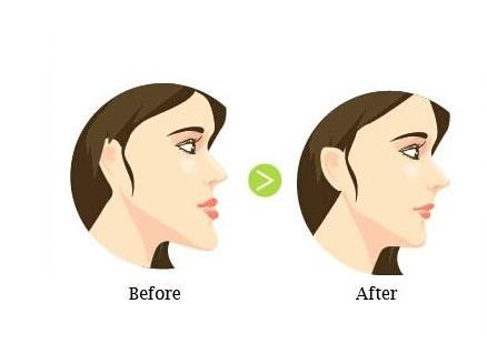 牙齿矫正能不能出现新的矫正方法,牙齿矫正一般是矫正什么情况