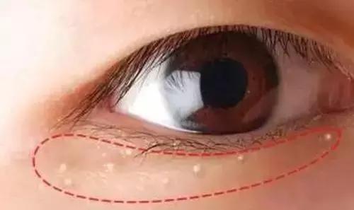 皮肤粗糙毛孔粗大暗黄怎么解决,皮肤干燥毛孔粗大如何改善