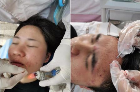 *疮痤**惹人恼，你了解多少？