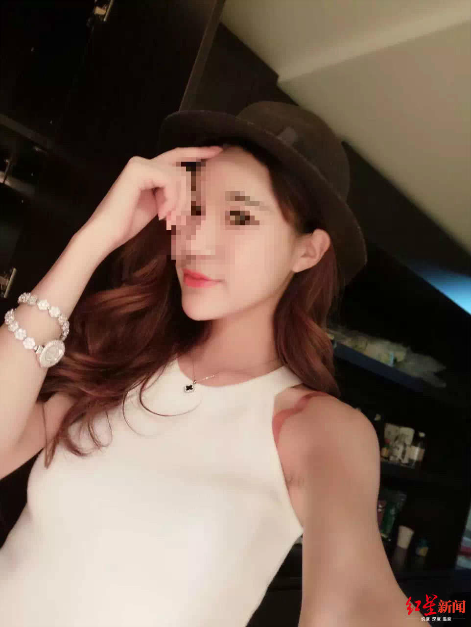 美容院拔火罐能改善哪些问题,拔火罐能美容养颜吗