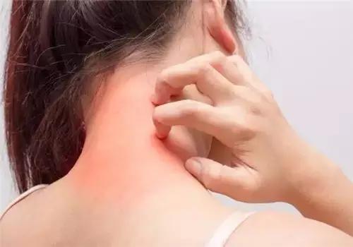 夏季甲醛挥发最厉害吗,夏季甲醛怎么去除最快最有效最好