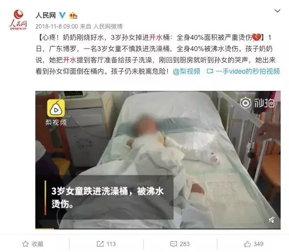 儿童烫伤第一时间的正确处理方法,儿童烫伤急救处理方法