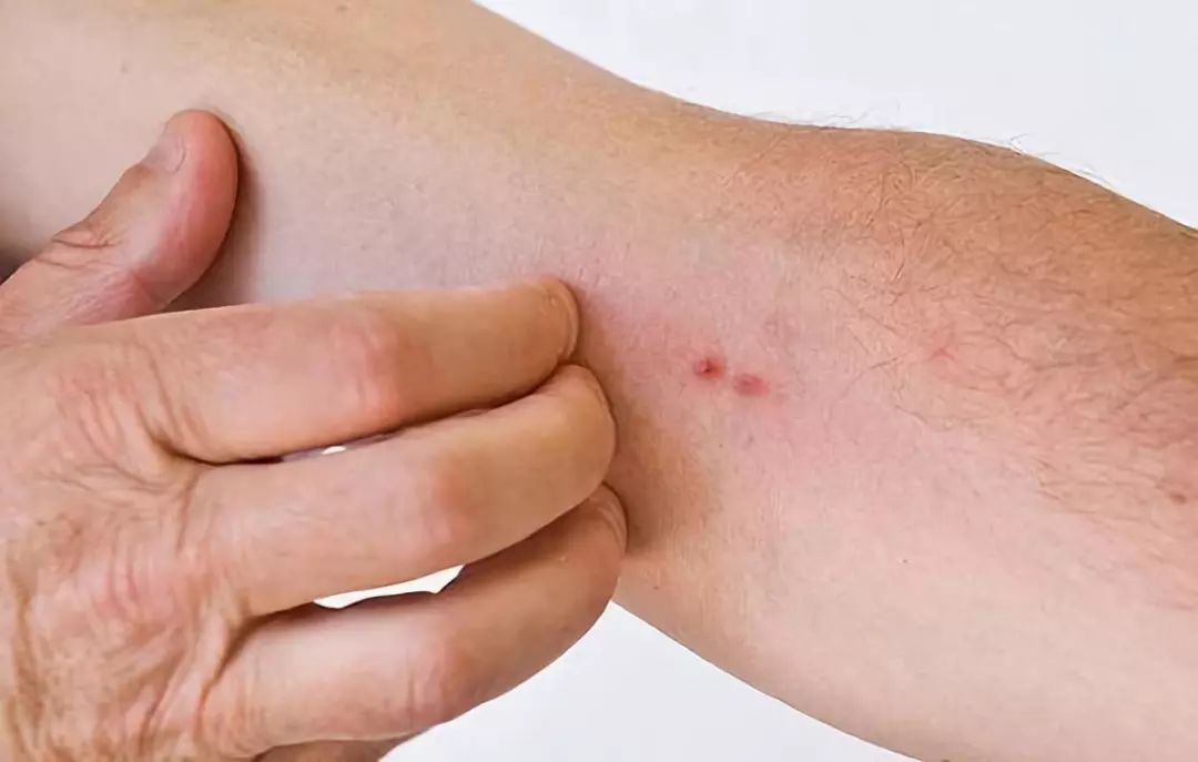 「科普益阳」秋冬季节皮肤为什么容易瘙痒？